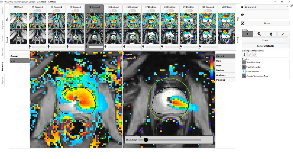 TDC 2.10 Max and Current